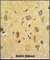 PPP2R2B Antibody (Center)
